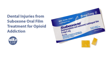 Image for Dental Injuries from Suboxone Oral Film Treatment for Opioid Addiction post